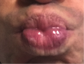 lips