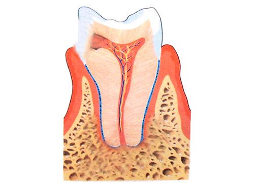 root-canal